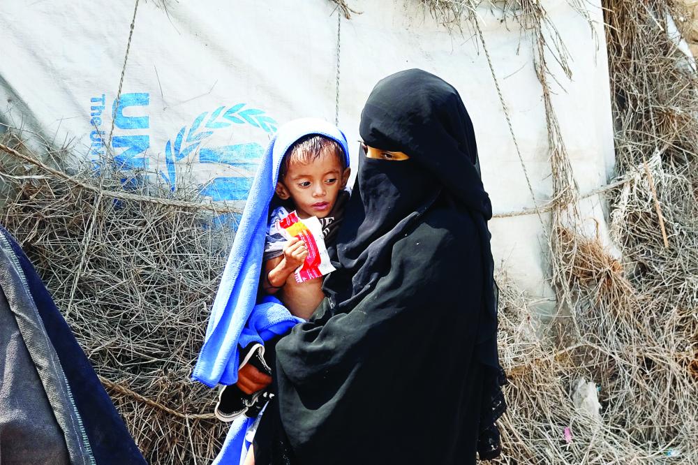 "A Yemeni woman displaced by conflict holds her son of two years and eight months, weighing only five kilograms, as she waits outside a shelter for the displaced in the war-ravaged western Hodeida province, on February 15, 2021. (Photo by Khaled Ziad / AFP)"