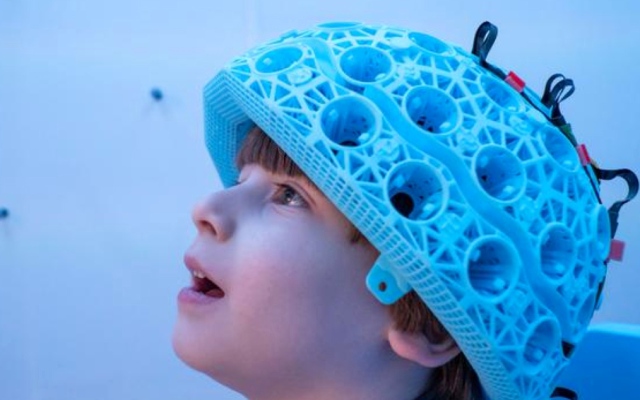 الصورة: الصورة: ماسح ضوئي يكشف أسرار تطور دماغ الأطفال